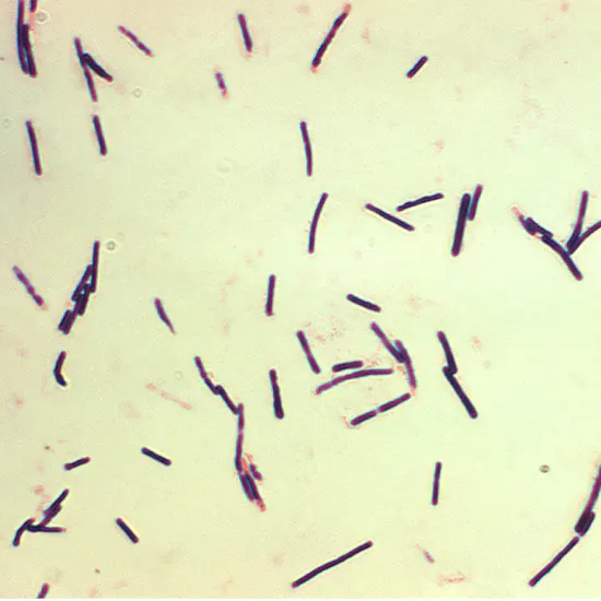 Understanding Clostridium Perfringens : Causes Symptoms and Prevention